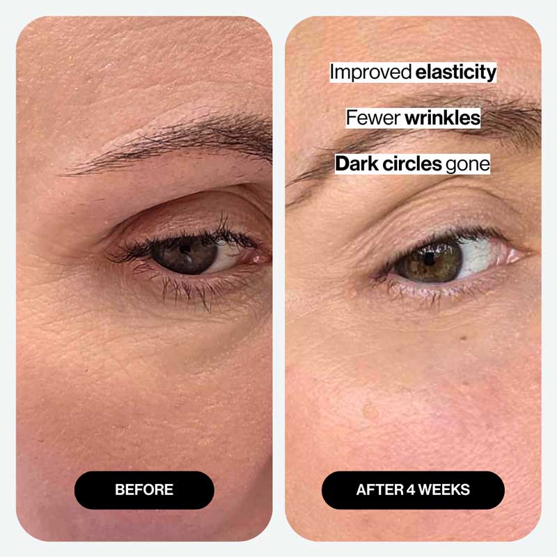 Punctual Kit | Once a Week Subscription